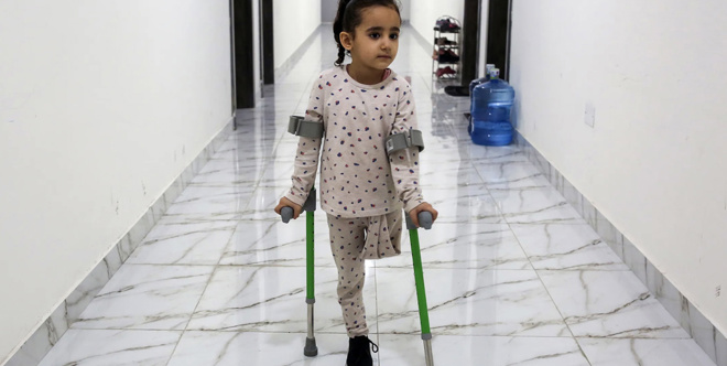 Prosthetics for children in Gaza 