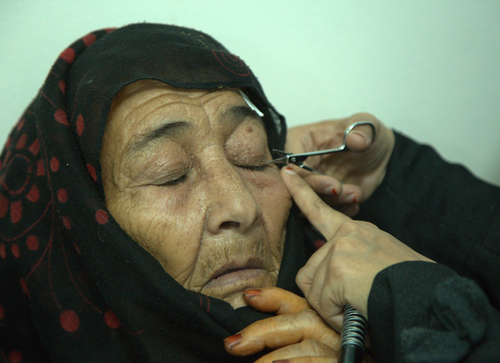 Yemen Cataract Surgery