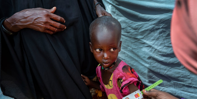Save Malnourished Children in Somalia