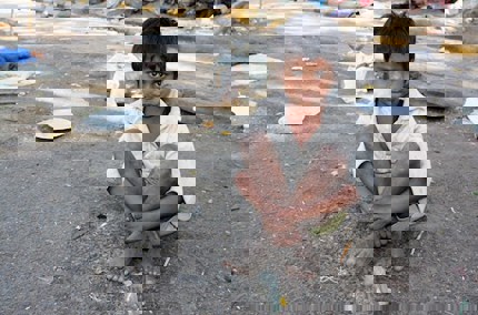 Malnutrition: the grim reality for many of India’s children