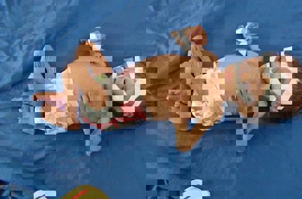 Children affected by poverty and conflict face diphtheria epidemic